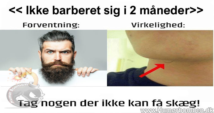 Ikke barberet sig i 2 måneder